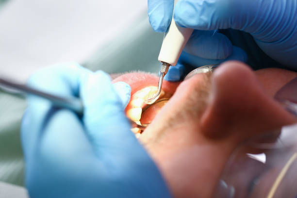 Best Broken Tooth Emergency  in Preston, IA