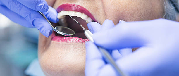 Best Emergency Dental Clinic in IA